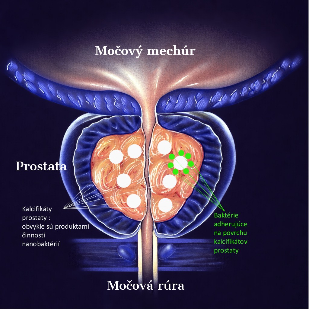 scaune frecvente cu prostatita